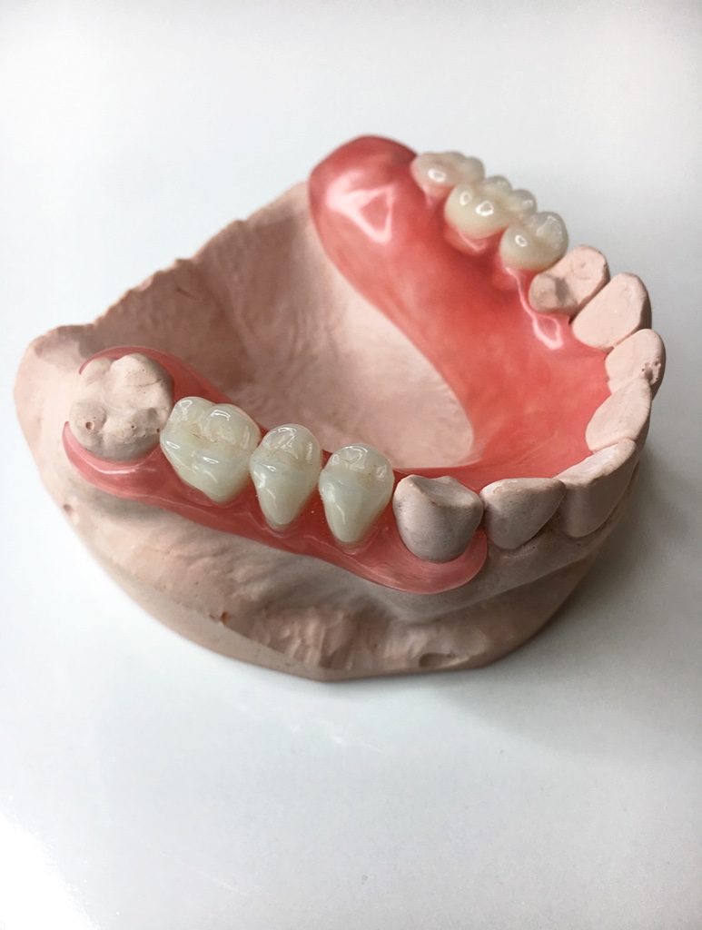 proteza elastyczna, acron, protezy elastyczne acron, protezy elastyczne lublin