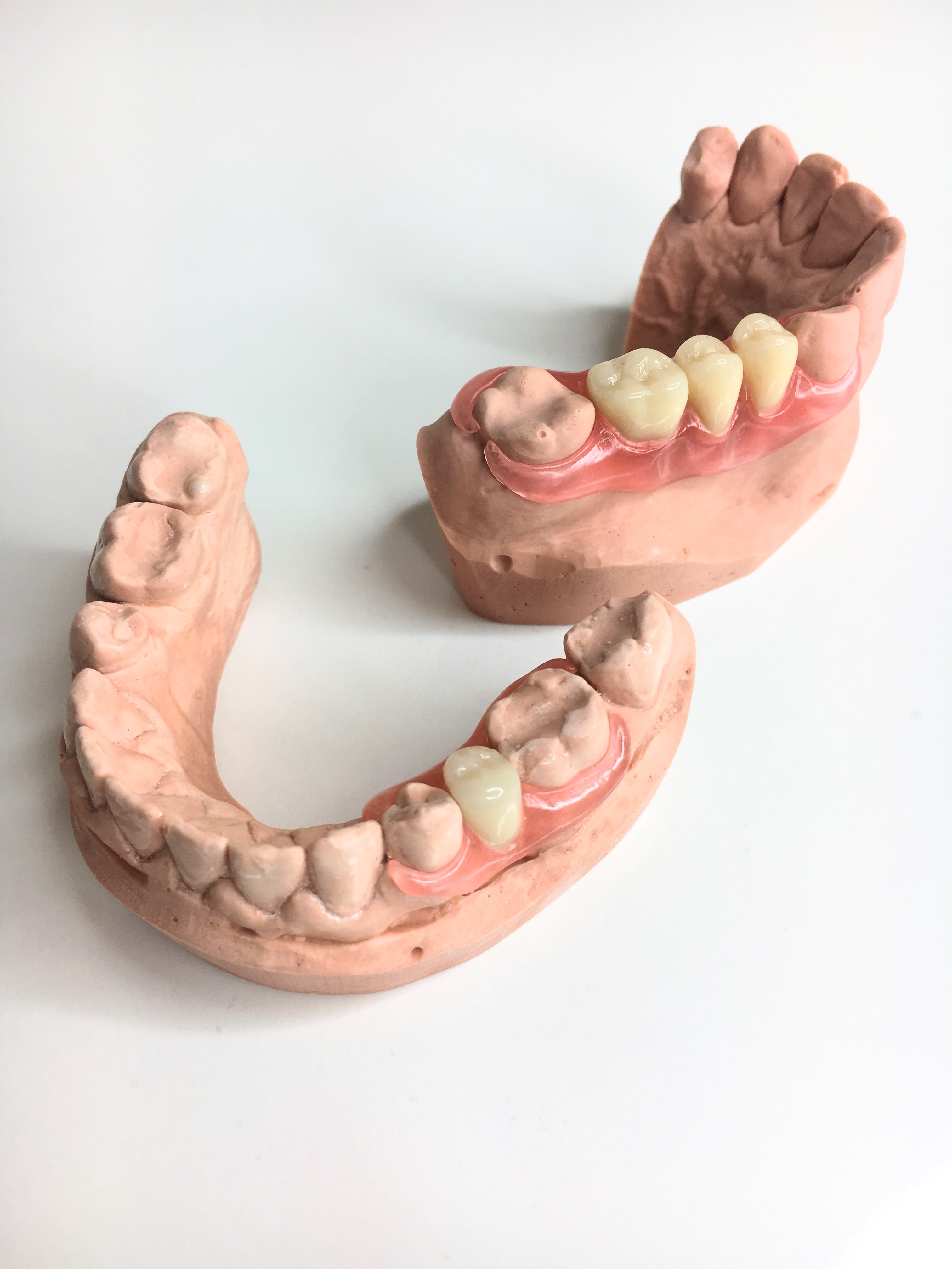 klips ząb, klips acron, klipsy z acronu